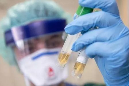 Коронавирустың Өзбекстанға кирип келиў мүмкиншилиги жоқары – Дүнья жүзилик денсаўлықты сақлаў шөлкеми
